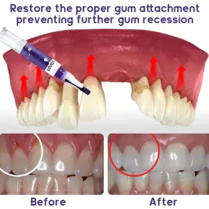 LOVILDS™ Gum Care Gel – Restore & Strengthen Your Gums image LOVILDS™ Gum Care Gel – Restore & Strengthen Your Gums