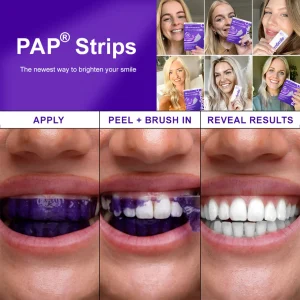 Flysmus® V34 Whitening Strips
