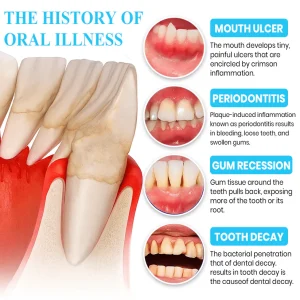 Lyyeto® Focussmile bee venom treatment powder for oral use image Lyyeto® Focussmile bee venom treatment powder for oral use