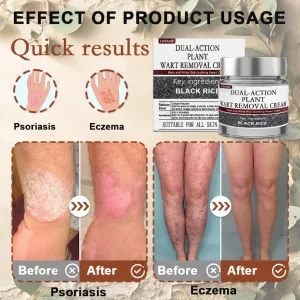 LOVILDS® Black Rice Skin Repair Essence Cream image LOVILDS® Black Rice Skin Repair Essence Cream