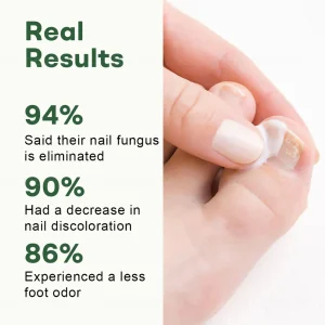 Dobshow® Nail Fungus Renewal Gel image Dobshow® Nail Fungus Renewal Gel