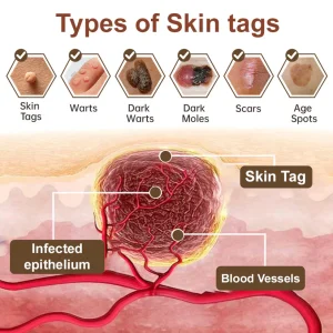 LOVILDS® Black Rice Skin Repair Essence Cream image LOVILDS® Black Rice Skin Repair Essence Cream