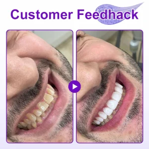 Zvoevo® New 7-Pro Intensive Toothpaste image Zvoevo® New 7-Pro Intensive Toothpaste