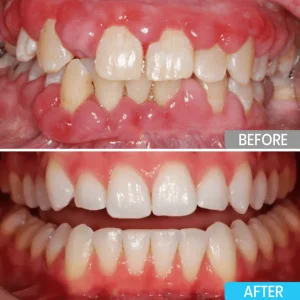 Lyyeto® Focussmile bee venom treatment powder for oral use image Lyyeto® Focussmile bee venom treatment powder for oral use