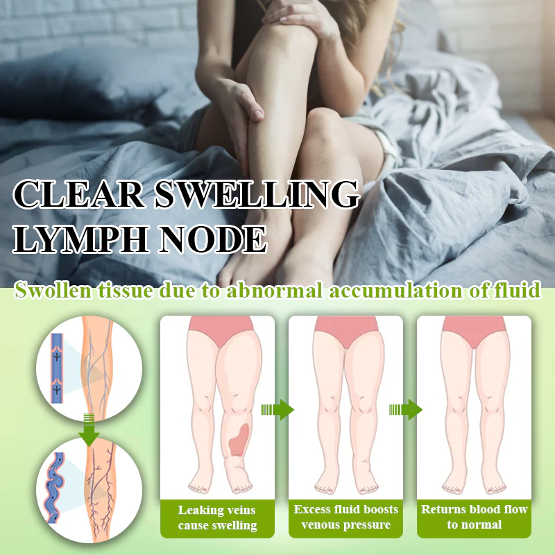 ATTDX® FluidiQ Edema Support Spray image ATTDX® FluidiQ Edema Support Spray