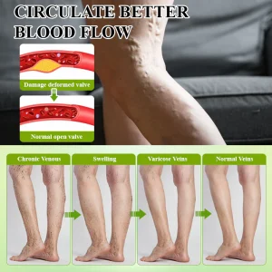 ATTDX® FluidiQ Edema Support Spray image ATTDX® FluidiQ Edema Support Spray