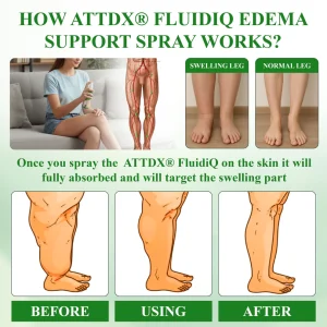 ATTDX® FluidiQ Edema Support Spray image ATTDX® FluidiQ Edema Support Spray