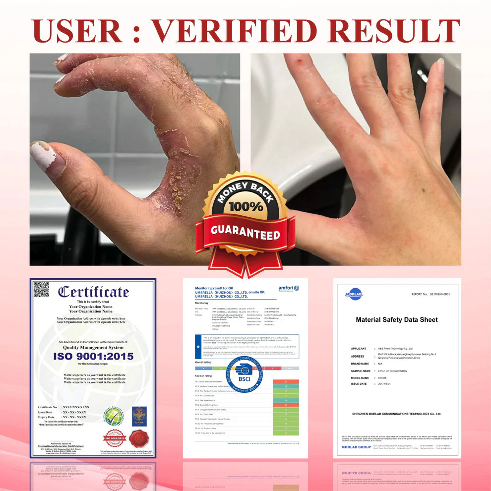 ALISANDA® GlucoseGuard Skin Rescue Cream image ALISANDA® GlucoseGuard Skin Rescue Cream