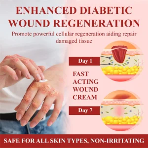 ALISANDA® GlucoseGuard Skin Rescue Cream image ALISANDA® GlucoseGuard Skin Rescue Cream