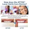 ATTDX® Laser Smile Care Device image ATTDX® Laser Smile Care Device