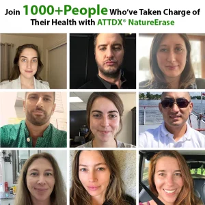 ATTDX® NatureErase Instant Alligator Oil Mole & Spot Cream image ATTDX® NatureErase Instant Alligator Oil Mole & Spot Cream