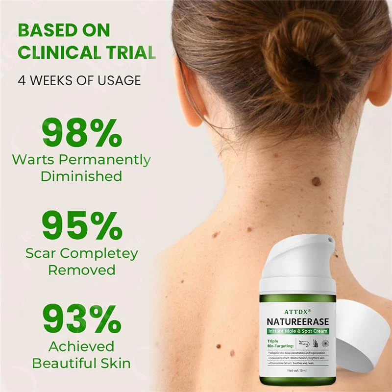 ATTDX® NatureErase Instant Alligator Oil Mole & Spot Cream image ATTDX® NatureErase Instant Alligator Oil Mole & Spot Cream