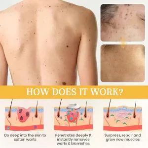 ATTDX® NatureStore Instant Mole & Spot Cream image ATTDX® NatureStore Instant Mole & Spot Cream