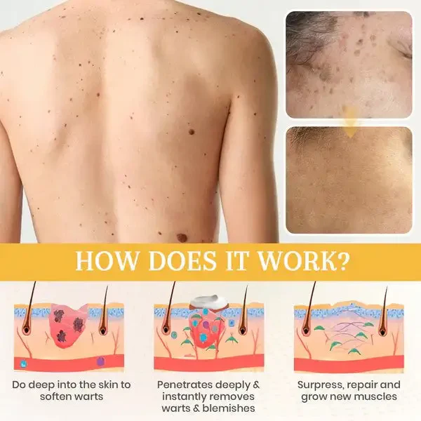 ATTDX® NatureStore Instant Mole & Spot Cream image ATTDX® NatureStore Instant Mole & Spot Cream