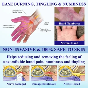 ATTDX® NumbAway CoolEase Neuropathy Spray image ATTDX® NumbAway CoolEase Neuropathy Spray