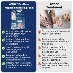ATTDX® PsoriEase Magnesium Healing Foam image ATTDX® PsoriEase Magnesium Healing Foam