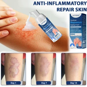 ATTDX® PsoriEase Magnesium Healing Foam image ATTDX® PsoriEase Magnesium Healing Foam