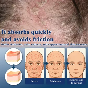 ATTDX® PsoriEase Magnesium Healing Foam image ATTDX® PsoriEase Magnesium Healing Foam