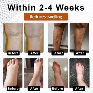 ATTDX® PumpkinFlow Kidney & Edema Support Softgels image ATTDX® PumpkinFlow Kidney & Edema Support Softgels