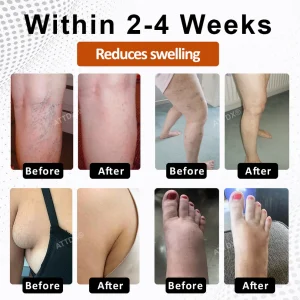 ATTDX® PumpkinFlow Kidney & Edema Support Softgels image ATTDX® PumpkinFlow Kidney & Edema Support Softgels