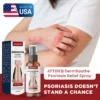 ATTDX® DermSoothe Psoriasis Relief Spray image ATTDX® DermSoothe Psoriasis Relief Spray