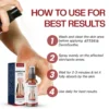 ATTDX® DermSoothe Psoriasis Relief Spray image ATTDX® DermSoothe Psoriasis Relief Spray