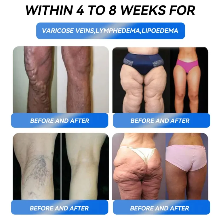 ZUNAFUN® GLP-1 Pro Weight Loss Oral Solution image ZUNAFUN® GLP-1 Pro Weight Loss Oral Solution