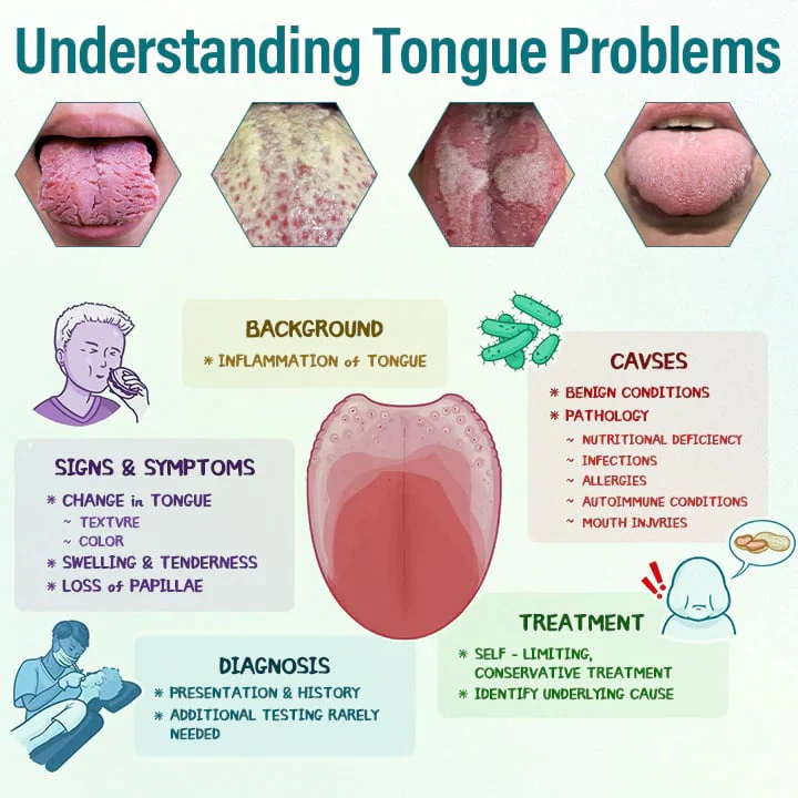 ATTDX® GlosShield Tongue Repair Spray image ATTDX® GlosShield Tongue Repair Spray