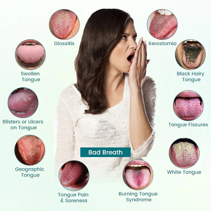 ATTDX® GlosShield Tongue Repair Spray image ATTDX® GlosShield Tongue Repair Spray