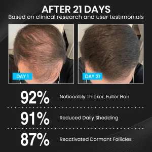 Lyyeto® HairRevix Advanced Hair Restoration Liquid Pearl image Lyyeto® HairRevix Advanced Hair Restoration Liquid Pearl