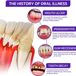 Rolimey® VioCore Bee Venom Dental Treatment Toothpaste image Rolimey® VioCore Bee Venom Dental Treatment Toothpaste