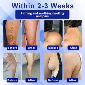 Elycura™ Lymphatic Drainage Massage Cream image Elycura™ Lymphatic Drainage Massage Cream