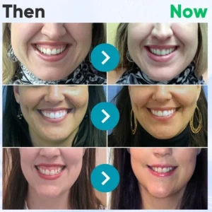 Rolimey® VioCore Bee Venom Dental Gum Therapy Toothpaste image Rolimey® VioCore Bee Venom Dental Gum Therapy Toothpaste