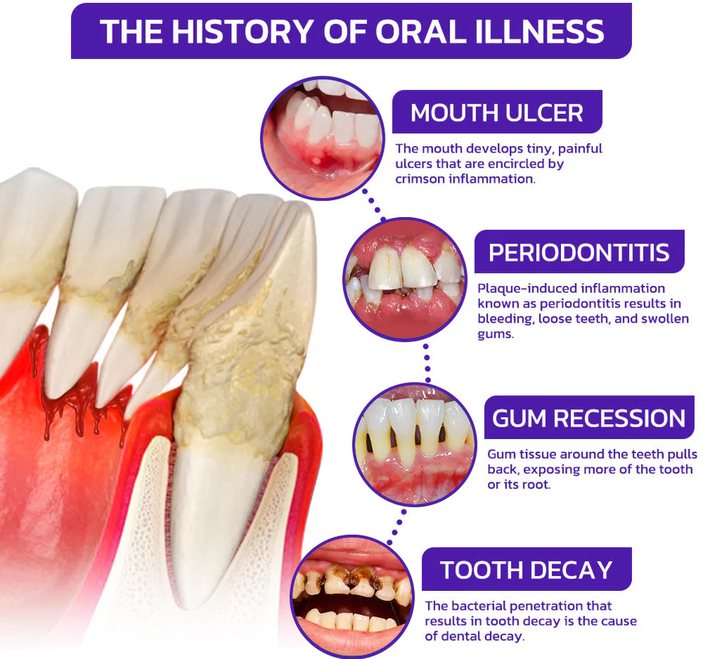 Rolimey® VioCore Bee Venom Dental Gum Therapy Toothpaste image Rolimey® VioCore Bee Venom Dental Gum Therapy Toothpaste